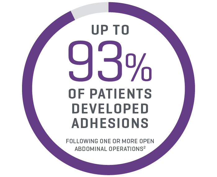 Up to 93% of abdominal operation patients developed adhesions			