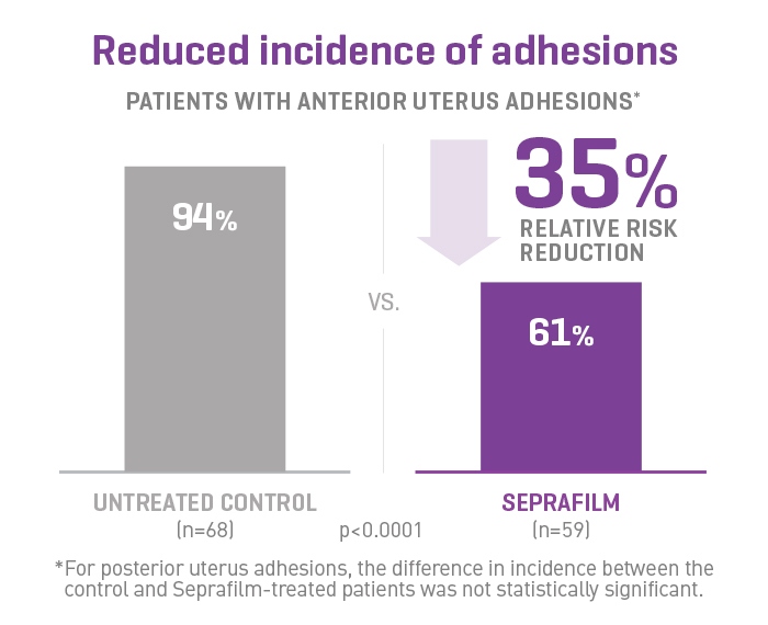 Seprafilm reduced incidence of adhesions