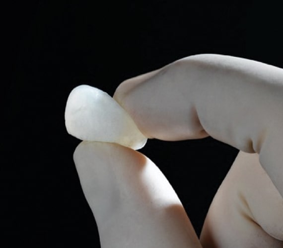 Gloved hand holding Ostene Bone Hemostasis Material